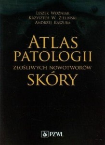 ATLAS PATOLOGII ZŁOŚLIWYCH NOWOTWORÓW SKÓRY