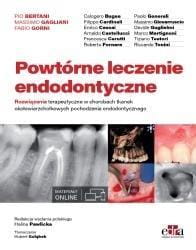 POWTÓRNE LECZENIE ENDODONTYCZNE
