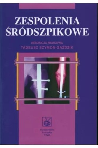 Zespolenia śródszpikowe, Szymon Gaździk